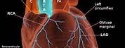 Aorta and Coronary Arteries