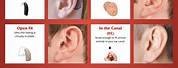 Different Kinds of Hearing Aids