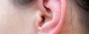 Dry Skin in Ear Canal