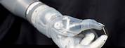 FDA-approved Prosthetic Arm