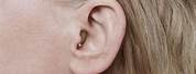 Hearing Aids Inside Ear Canal