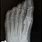 5th Metatarsal Avulsion Fracture