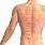 Acupuncture Points for Upper Back Pain