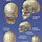 Adult Skull Sutures