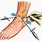 Ankle Arthrotomy