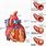 Atherosclerosis Heart Disease