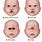 Babies with Cyclopia