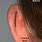 Behind the Ear Anatomy