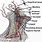 Carotid Artery in Neck Location
