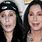 Cher Botox