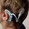 Cochlear Ear Implant