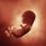 Embryo at 15 Weeks