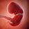 Embryo at 8 Weeks