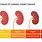 Five Stages of Kidney Disease