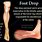 Foot Drop Peroneal Nerve Injury