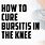 Knee Bursa Treatment