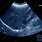 Liver Ultrasound Scan