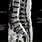 Lumbar Spine MRI Abnormalities