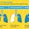 Lung Surgery Types
