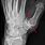 MRI Thumb Joint