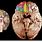 Medial Orbitofrontal Cortex