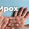 Mpox Causes