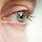Myopia Control Contact Lenses