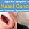 Nasal Cancer Inside Nose