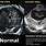 Normal Fetal Head Ultrasound