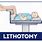Patient in Lithotomy Position