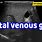Portal Venous Gas Ultrasound
