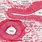 Pulmonary Artery Histology