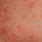 Red Itchy Rash Over Body