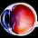 Retinal Ganglion