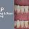 SRP Dental Meaning