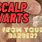 Scalp Warts Treatment