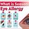 Seasonal Allergies Eyes
