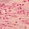 Sputum Gram Stain