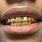 Teeth with Gold Teeth