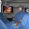 Thoracic Surgery Lung Cancer