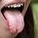 Thrush On Your Tongue