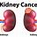 Types of Kidney Tumors
