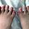 Weird Foot Diseases