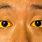 Yellowing Eyes