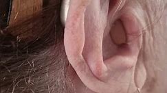 HOW TO INSERT YOUR HEARING AID❗️#shorts #fypシ #trending #viral #amazing #hearingaid