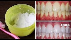 Le Bicarbonate de Soude Pour Des Dents Blanches en seulement 5 Minutes