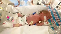 Baby born 12 weeks early - weighing less than a loaf of bread - now thriving