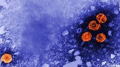 ¿Qué es la hepatitis? Síntomas, tratamiento, riesgos