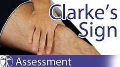 Clarke's Sign / Patellar Grind Test | Patellofemoral Pain / Chondromalacia Patellae