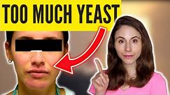 6 SIGNS OF TOO MUCH YEAST *SKIN* @DrDrayzday